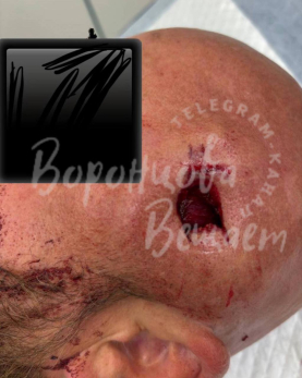 Мигрант выстрелил в голову мужчине у здания правительства Самарской области