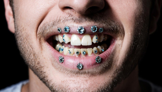 Блестящий рот: зумеры ввернули моду на драгоценные зубы - гриллзы против золотых коронок