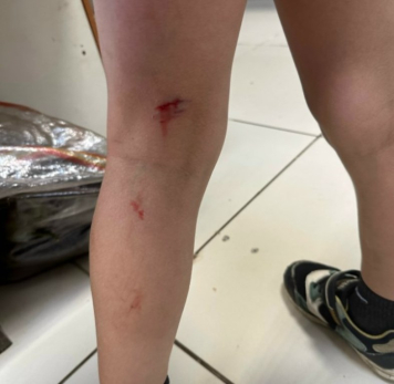 В Сызрани около торгового центра собака вцепилась зубами в ребенка