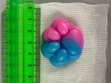 Врачи бьют тревогу из-за коварной игрушки: проглоченная таба-лапка резко увеличилась в желудке ребенка