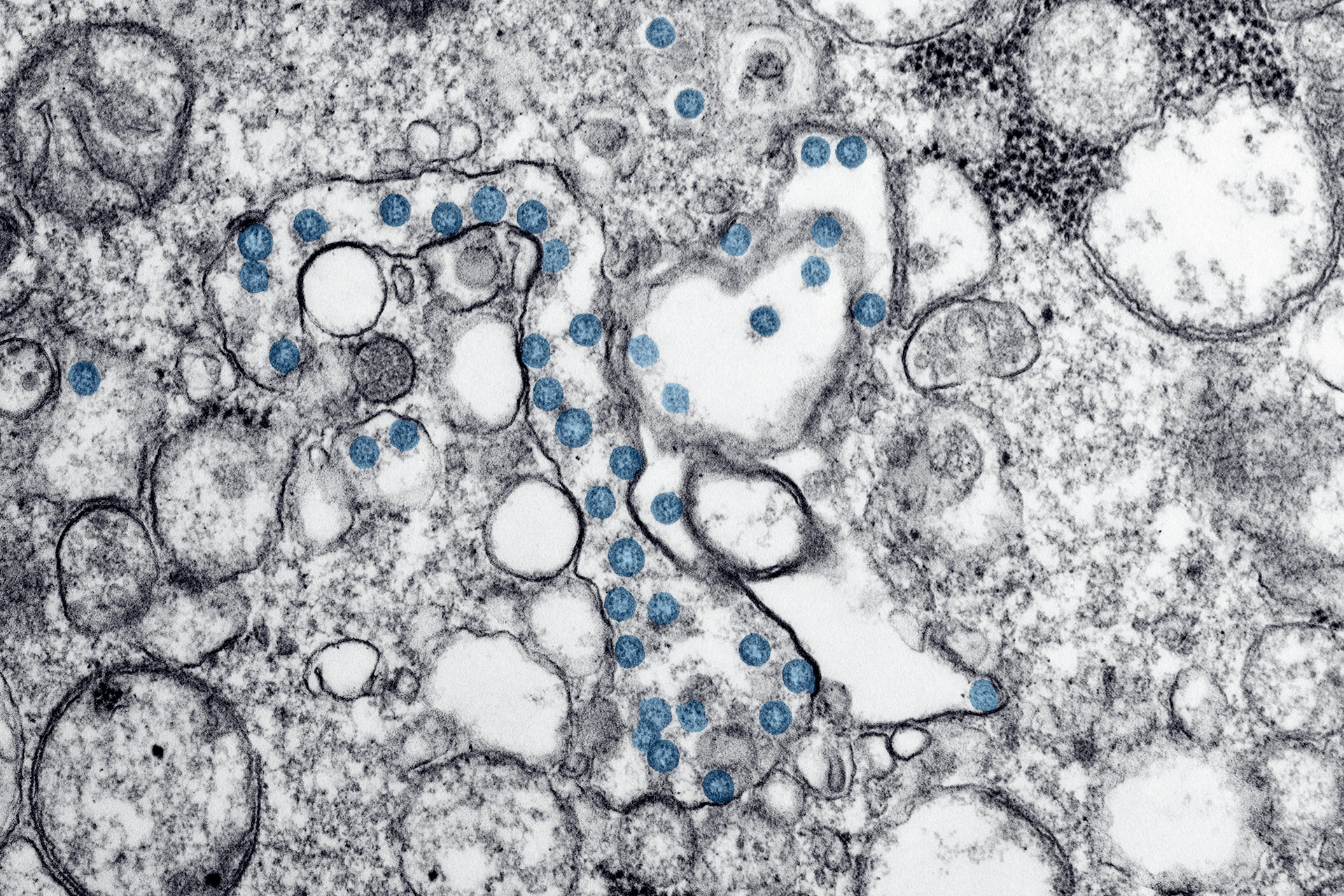 Covid-19 микроскоп. Вирус ковид. Вирус SARS-cov-2 под микроскопом. Вирус Covid 19 под микроскопом. Коронавирус 2 2020