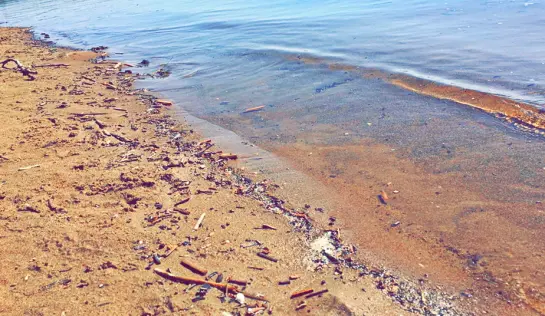 Уже есть первые жертвы среди желающих искупаться: как распознать и лечить церкариоз