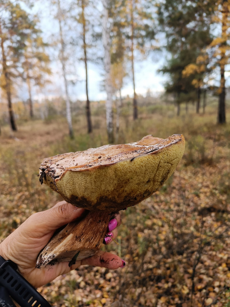 Заболеваемость раком растёт, а выживаемость — падает